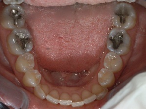 مطالب دندانپزشکی