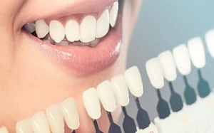 انواع روشهای درمانی در دندانپزشکی