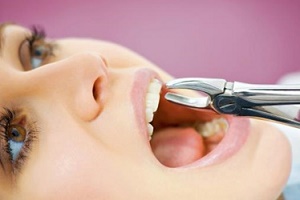 مراقبتهای پس از جراحی و کشیدن دندان